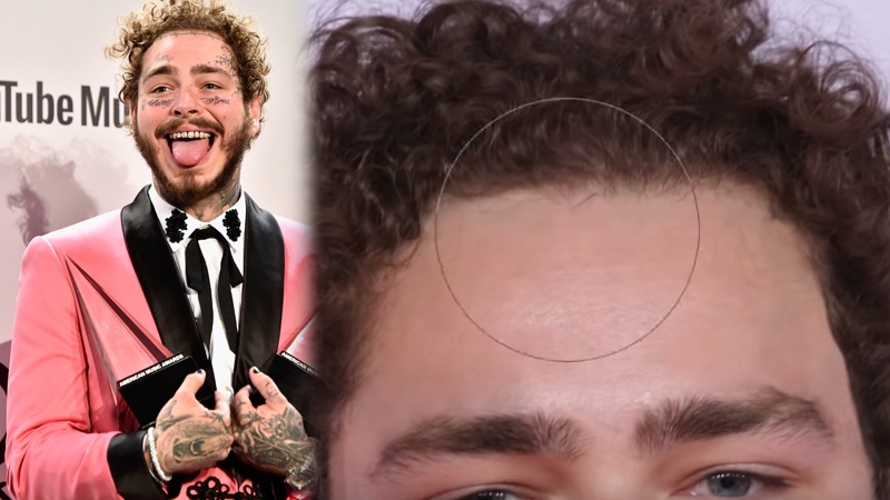 Details 77 post malone no face tattoos best  thtantai2